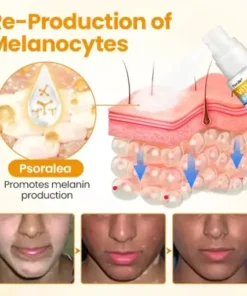 VitiGone Rapid Spray