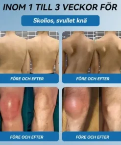 𝖯𝗂𝖼𝗱𝗼® BPC-157 Ledhälsande kräm