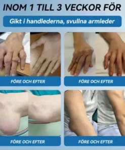 𝖯𝗂𝖼𝗱𝗼® BPC-157 Ledhälsande kräm