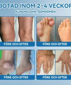 𝖯𝗂𝖼𝗱𝗼® BPC-157 Ledhälsande kräm