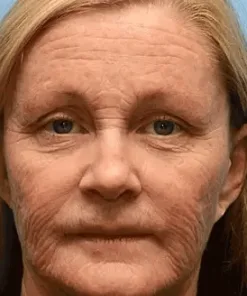 Bee Essence Skin Antibacterial Cream