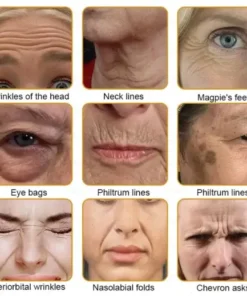 Bee Essence Skin Antibacterial Cream