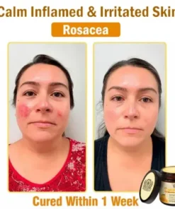 Bee Essence Skin Antibacterial Cream