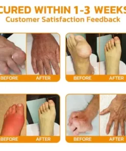 Bee Venom Joint Repair Cream