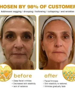 Botox Bee Venom Wrinkle Removal Cream
