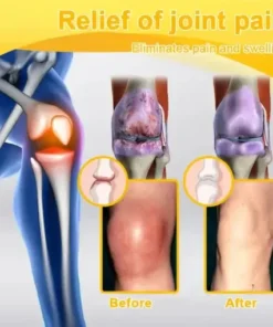 Botulinum Toxin & Bee Venom Pain-Relief Bone Healing Cream