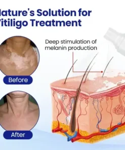 Evenora Herbal Spray PRO