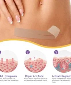 Hyaluronic Acid Nano Microneedle Repair Tape