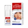 Vitiligo Treatment Spray