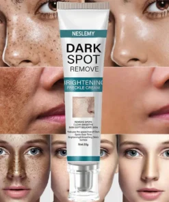 Blemish Removing Beauty Cream