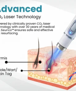 Laser Pen - Non-invasive Mole and Wart Removal