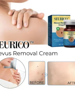 Nevus Removal Cream