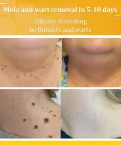 TagCure Bee Venom Cream