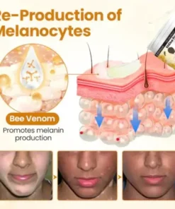 VitiClear Pro Bee Venom Cream