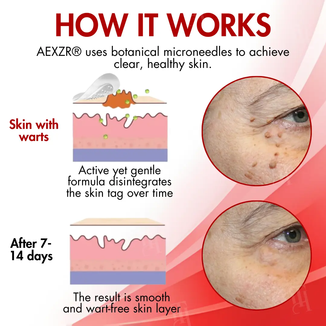 Nano-Microdart Skin Tag & Spot Corrector Patches - Image 5