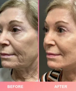 LIMETOW® Compact Anti-Wrinkle Bar