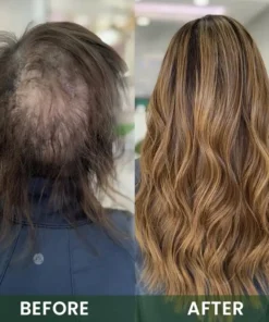 LIMETOW® Hair Boost Spray