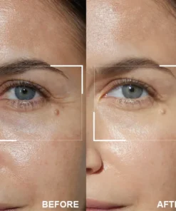 LIMETOW™ Retinol Eye Stick