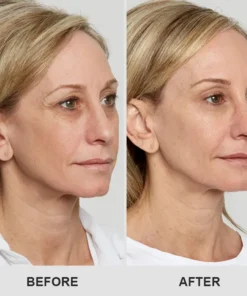 LIMETOW™ Retinol Eye Stick