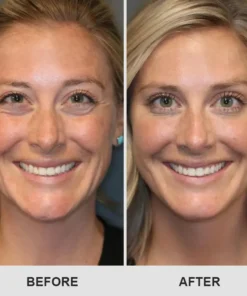 LIMETOW™ Retinol Eye Stick