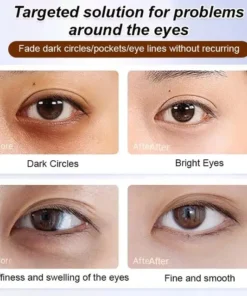 LIMETOW®Anti-wrinkle eye serum oil