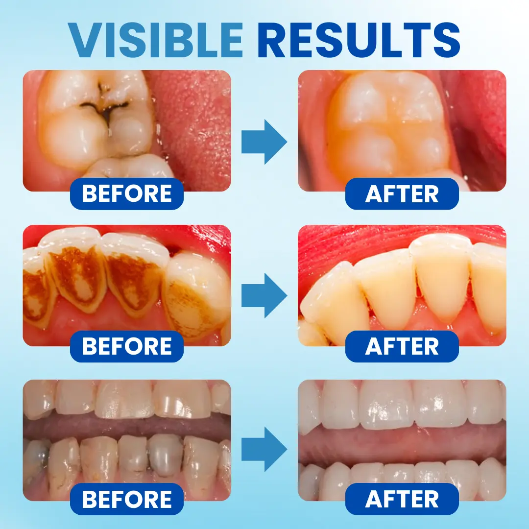 Anti-Plaque Oral Serum - Image 6