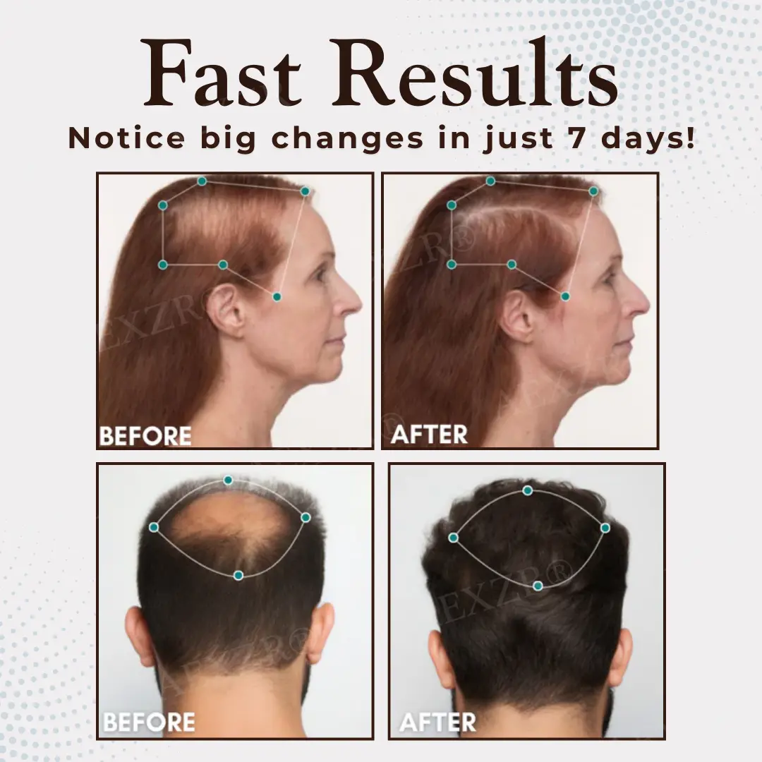 Bio-Signal Hair Regrowth Capsules - Image 2