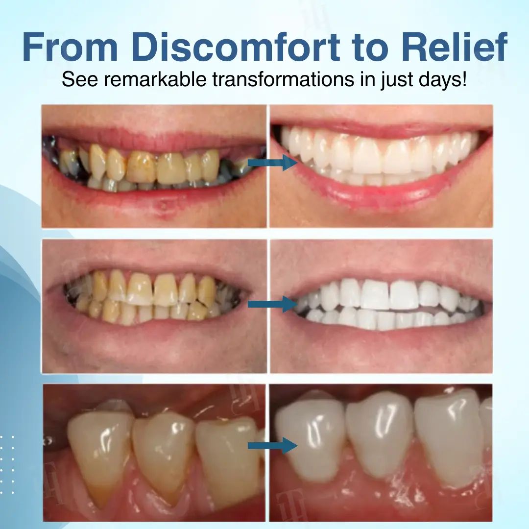 Dental Pulp Repair Regeneration. - Image 2