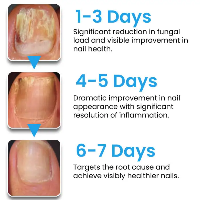 NanoFix Repair Pen - Image 6