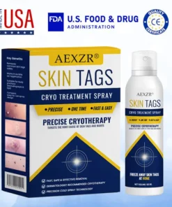 Skin Tag Cryo Treatment Spray Precision Cryo-Tech Freezes Away Skin Tags Warts in Seconds No Blades, No Pain.