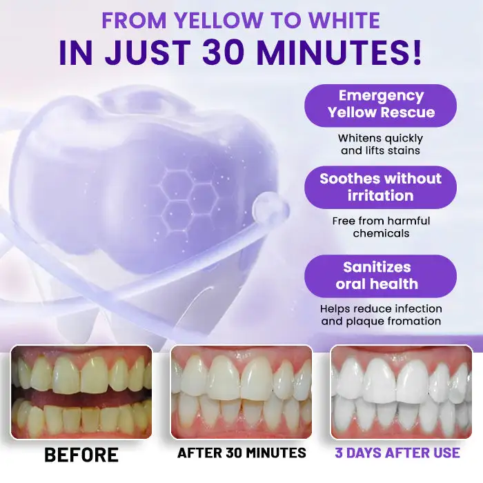V34 Whitening Strips - Image 3