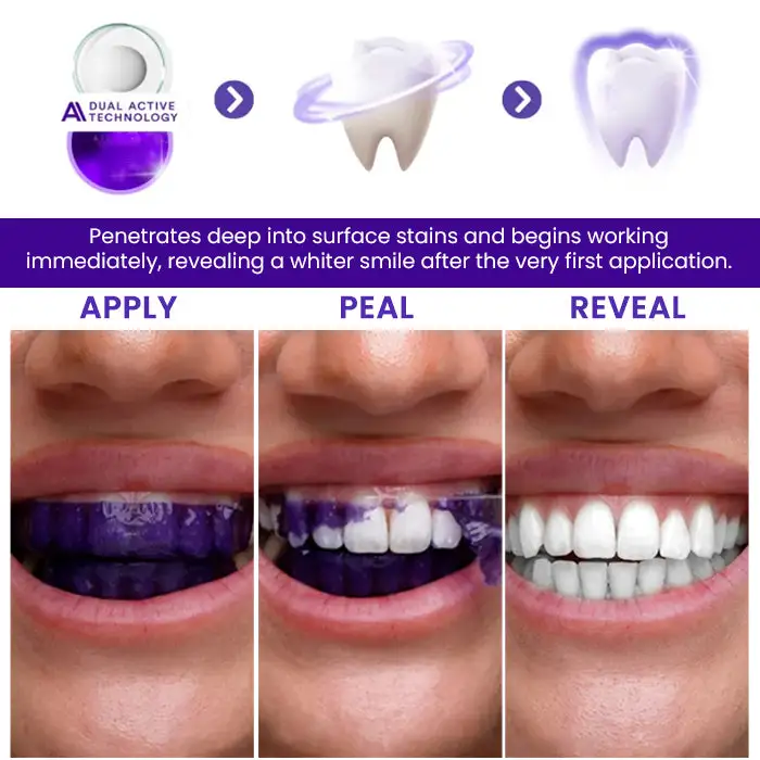 V34 Whitening Strips - Image 4