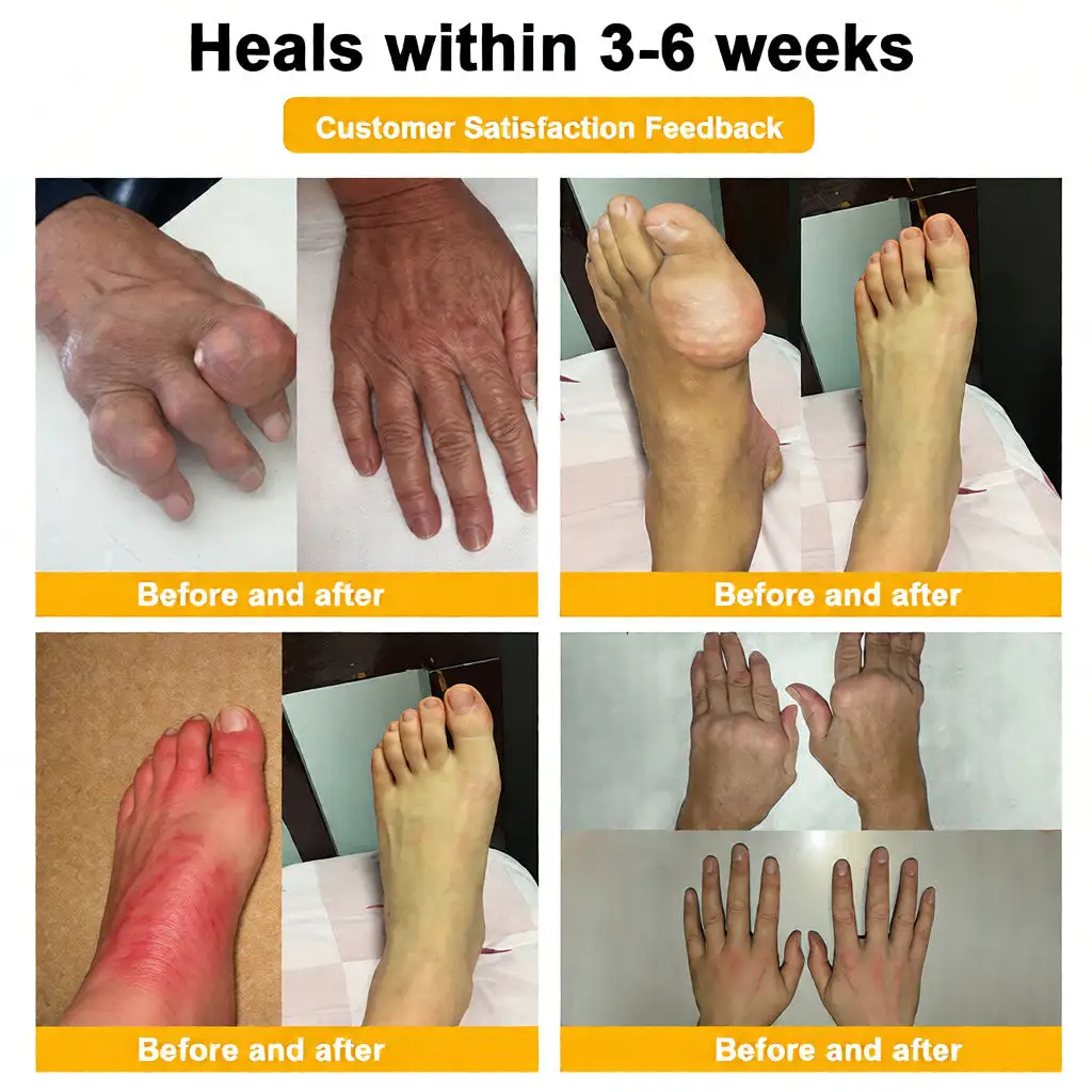 Bee Venom Pain-Relief Bone Healing Cream (Specially for older adults) - Image 4