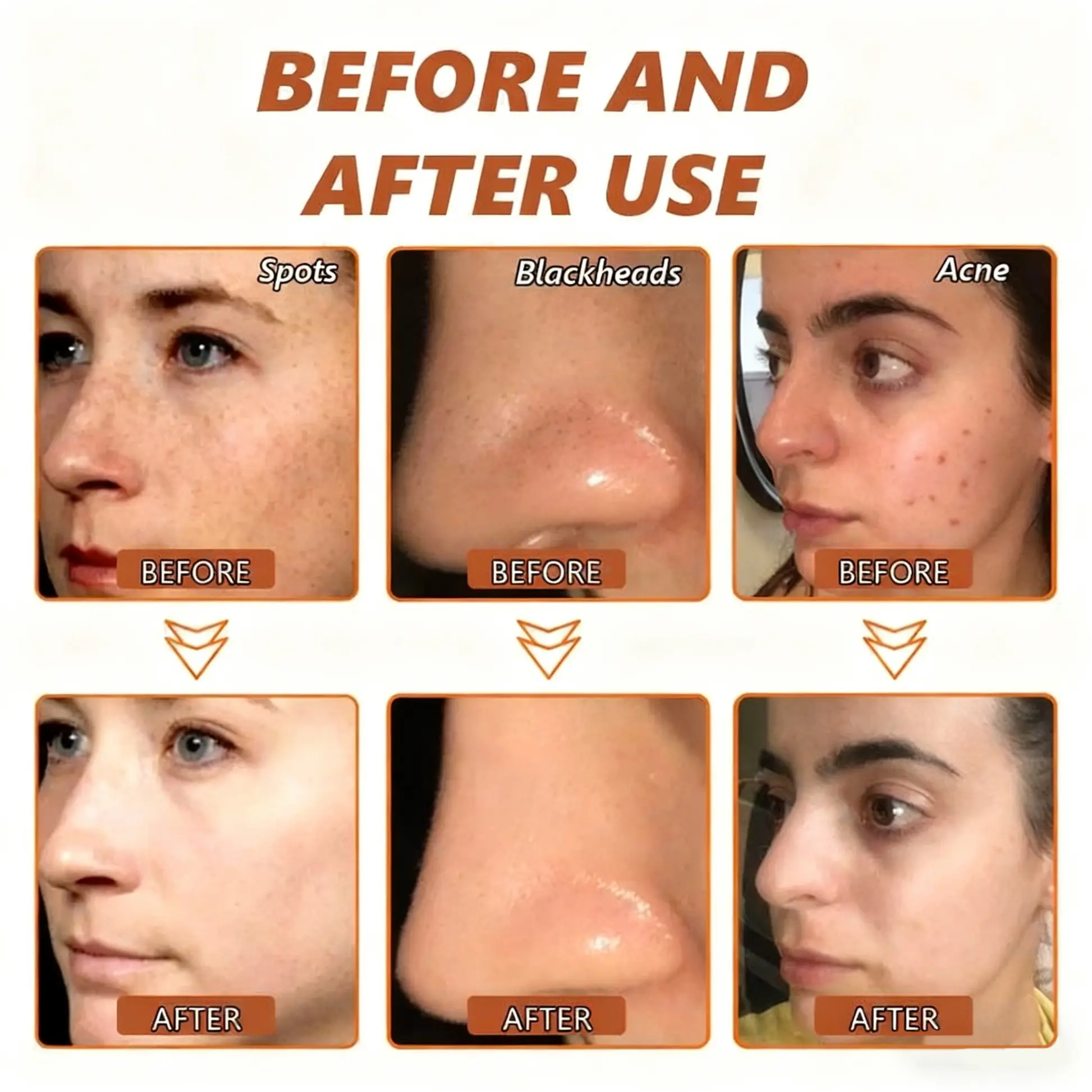 Whitening and Spot-Removing Face Mask Suitable for face and body - Image 11