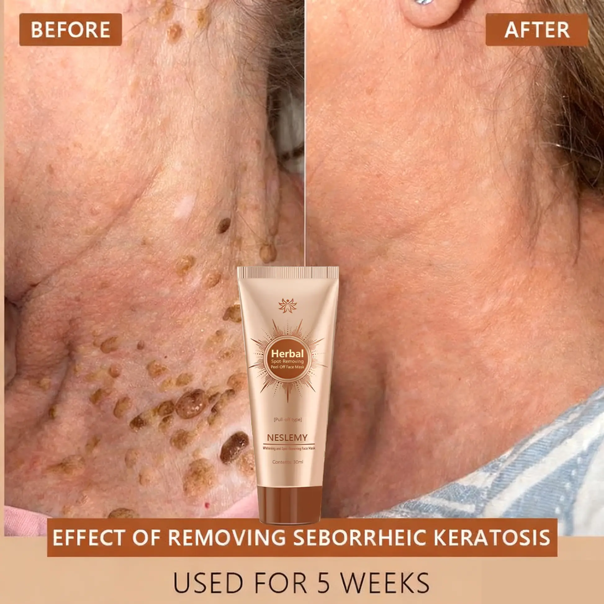 Whitening and Spot-Removing Face Mask Suitable for face and body - Image 4