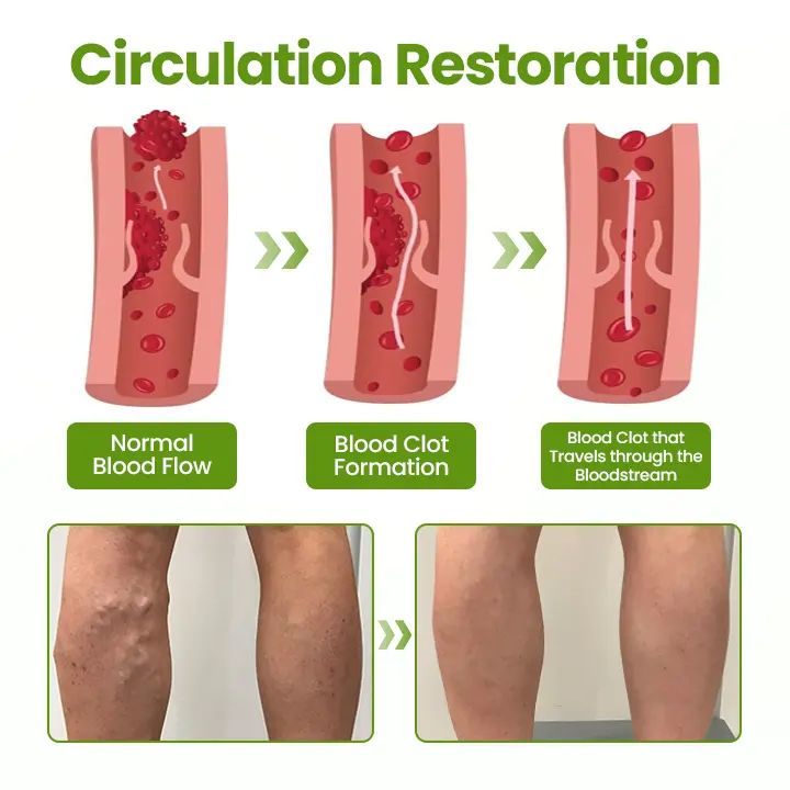 VeinEase Leg Mask - Image 5