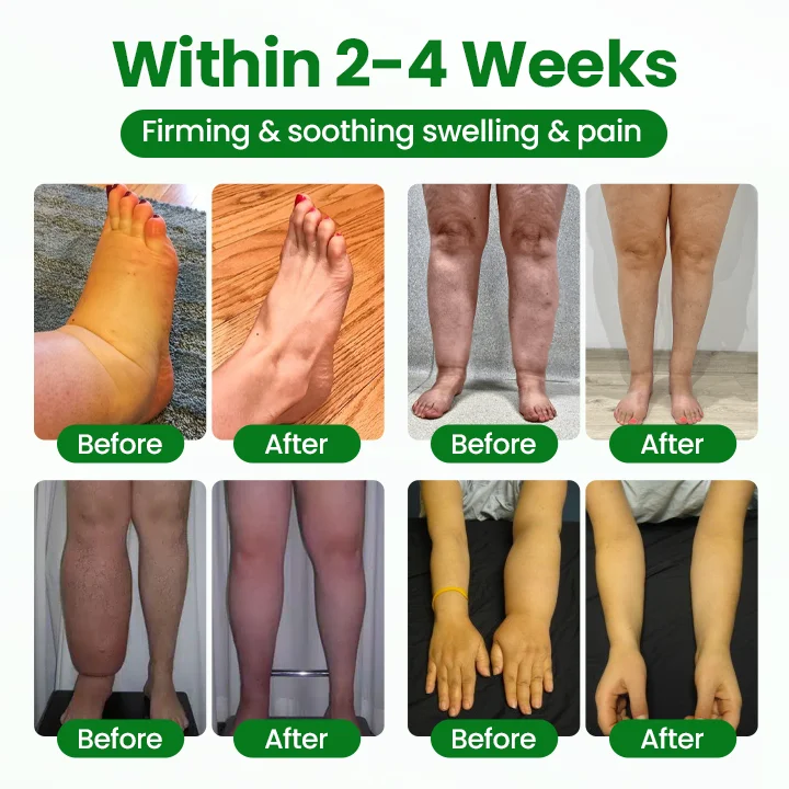 VenoSoothe Leg Relief Spray - Image 2