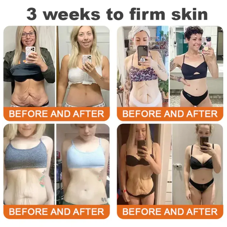 Bee venom Pro Comprehensive Cream - Image 3