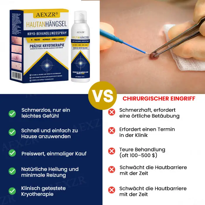 HautanhÀngsel-Kryo-Behandlungsspray (ðð¢ðð¡ðððð«ð ððð«Ã€ð§ððð«ð®ð§ð ðð§ ð¢ð§ ð ððð ðð§) ð
ÃŒð« ððð®ððð§ð¡Ã€ð§ð ð¬ðð¥, ððð«ð³ðð§, ððð¥ð, ð ð¥ðððð ððð®ð, ð®ð§ð ðŠðð¡ð« - Image 5