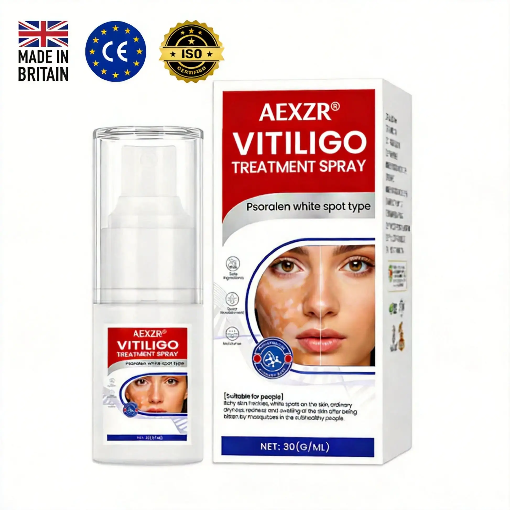 Vitiligo Treatment Spray