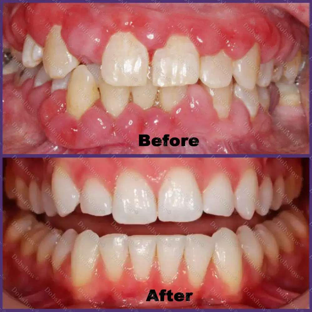 ApiCore BeeVenom Vital Repair Toothpaste - Image 3