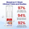 Vitiligo Treatment Spray