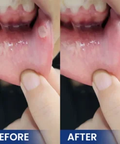 LIMETOW® Bee Venom Oral Care Solution