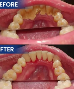 LIMETOW® Bee Venom Oral Care Solution