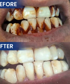 LIMETOW® Bee Venom Oral Care Solution