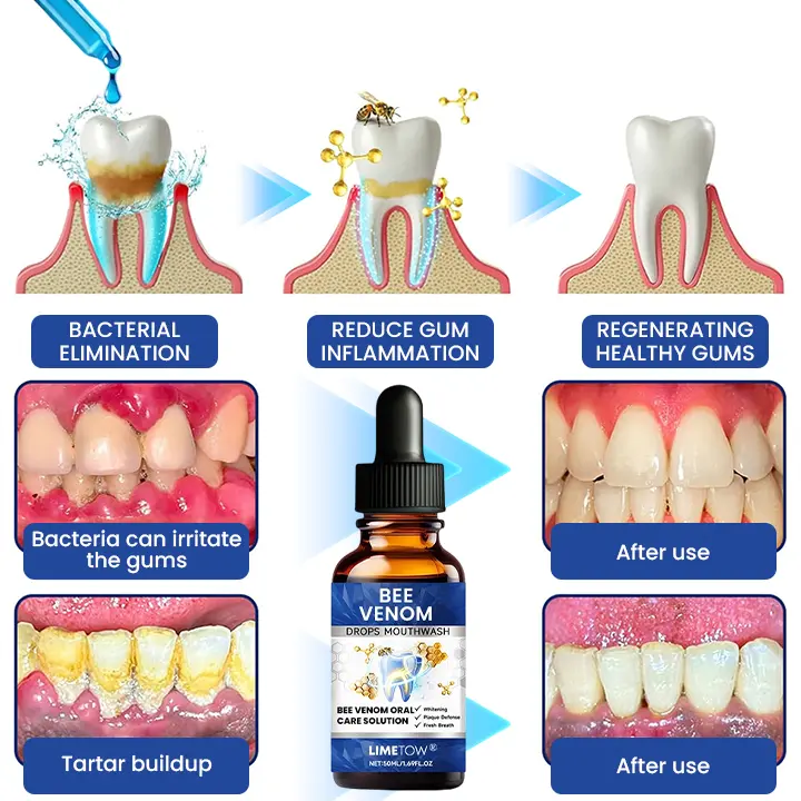 LIMETOW® Bee Venom Oral Care Solution