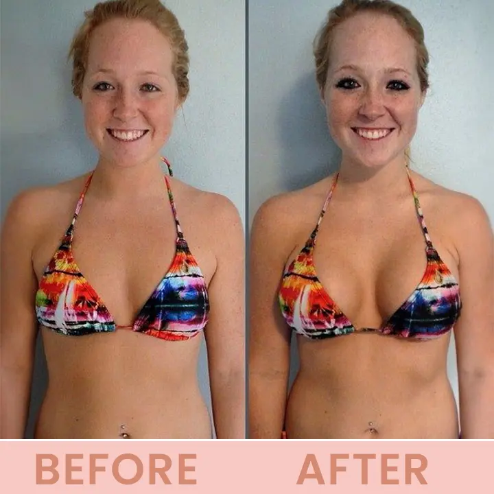 LIMETOW® Bust Lift Oil