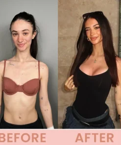 LIMETOW® Bust Lift Oil