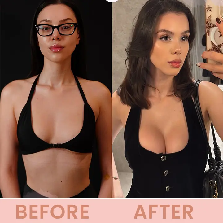 LIMETOW® Bust Lift Oil