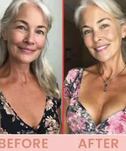 LIMETOW® Bust Lift Oil